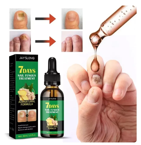 Aceite anti-hongos uñas - Imagen 4