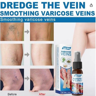 Spray para Varices - Imagen 2