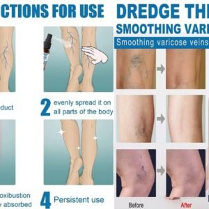 Spray para Varices