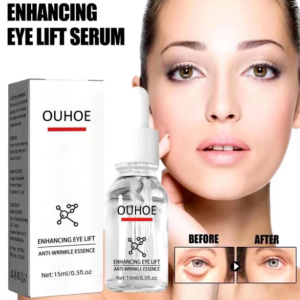 Serum quita Ojeras