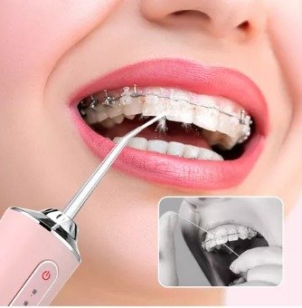 Irrigador dental portátil 220 ml con 3 modos y 4 boquillas - detalle 3